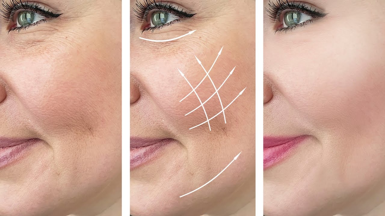 بوتوكس طبيعي من مطبخك للقضاء على التجاعيد وتفتيح البشرة بأقل تكلفة