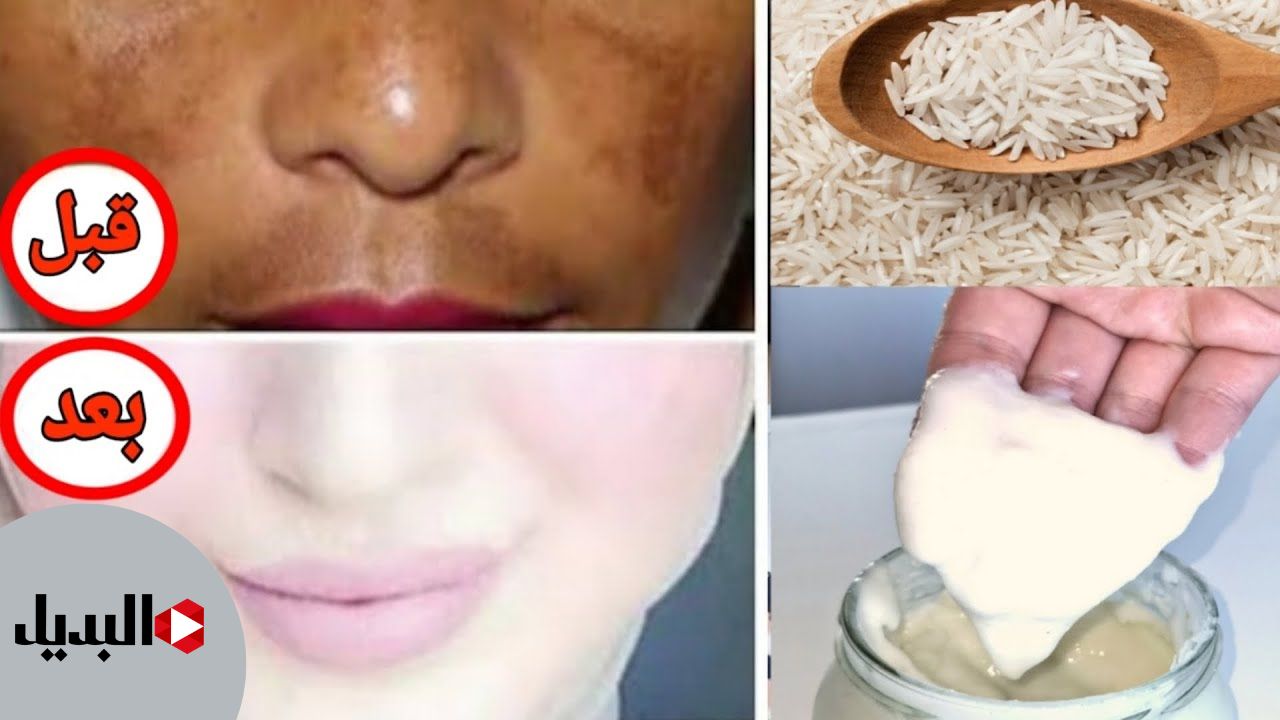 “معجزة التفتيح في بيتك” خلطة تفتيح الجسم والبشرة من أول مرة من غير التهابات في 5 دقايق